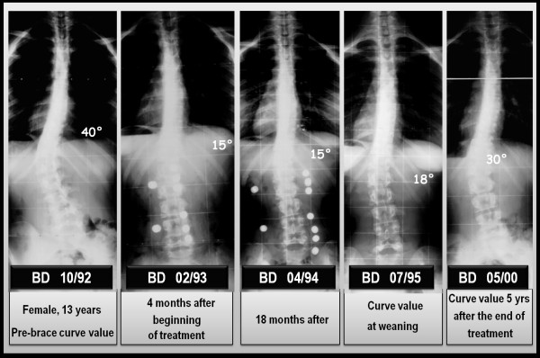 Figure 18