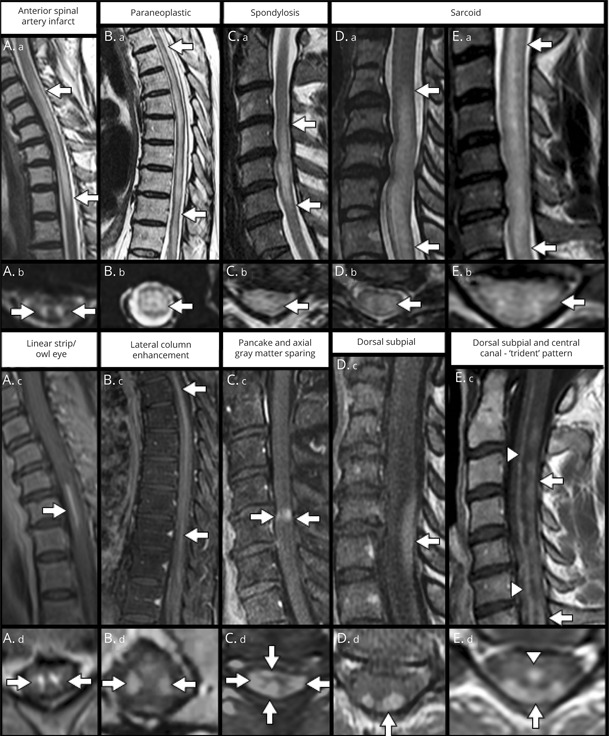 graphic file with name NEURCLINPRACT2020064386FFU1.jpg