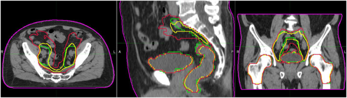 Fig. 7