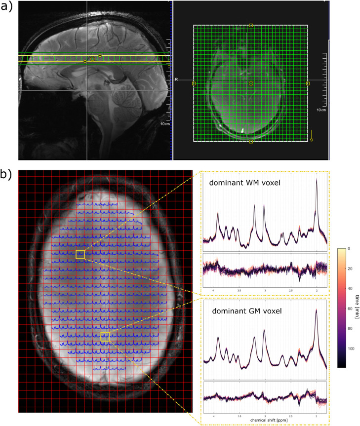 Fig. 1: