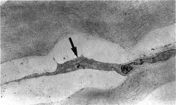 FIGURE 5B