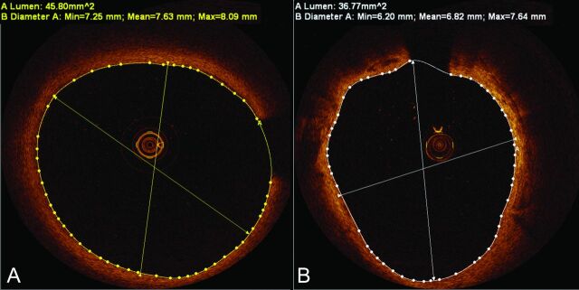 Fig 4.