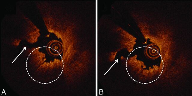 Fig 2.