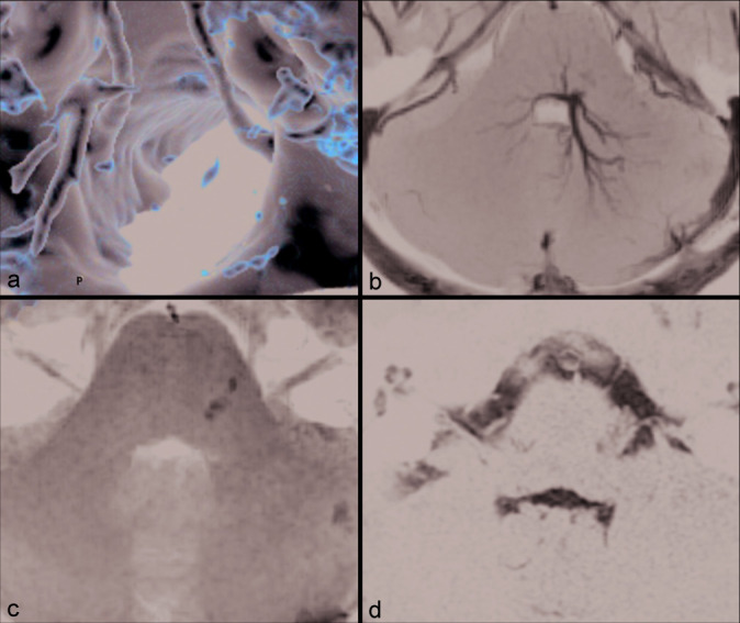 Figure 3: