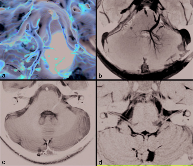 Figure 1: