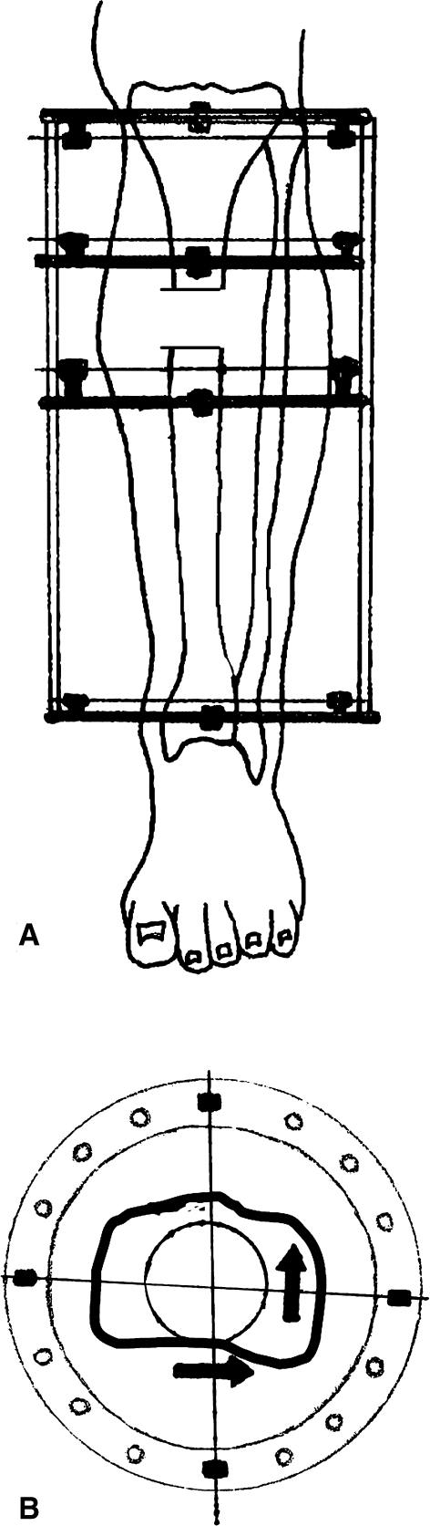 Fig. 2A–B