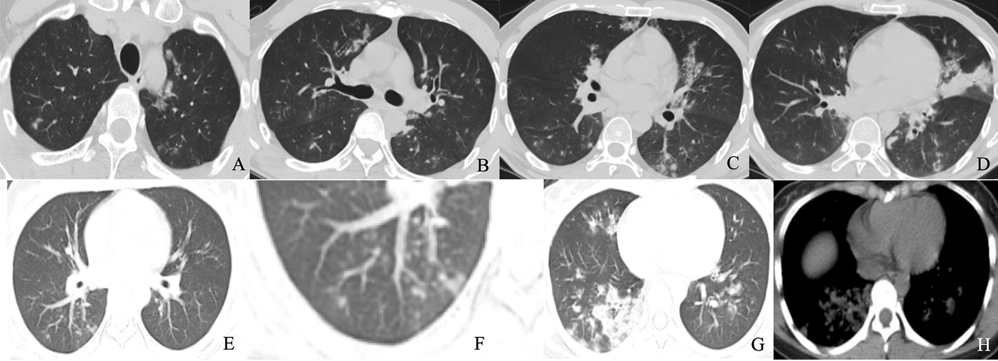 Fig. 4