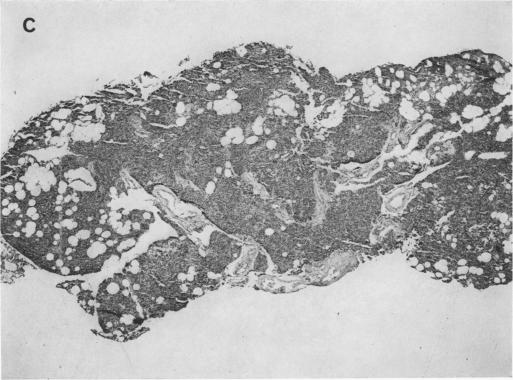 Fig. 1C.