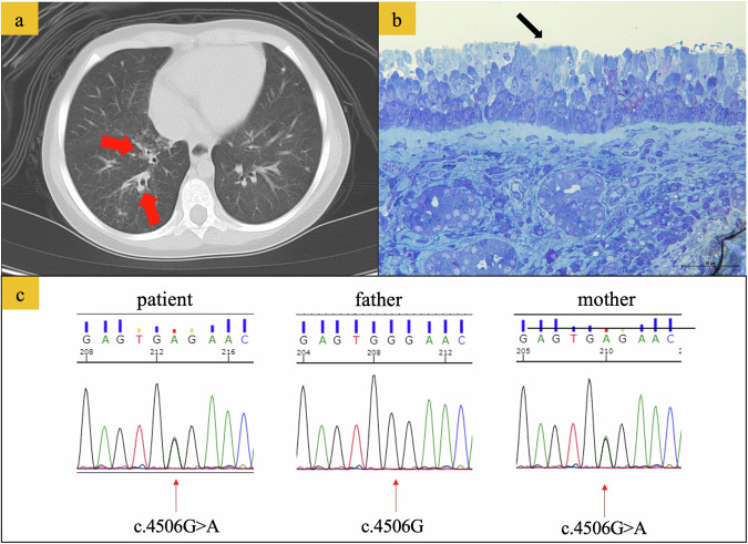 Fig. 2