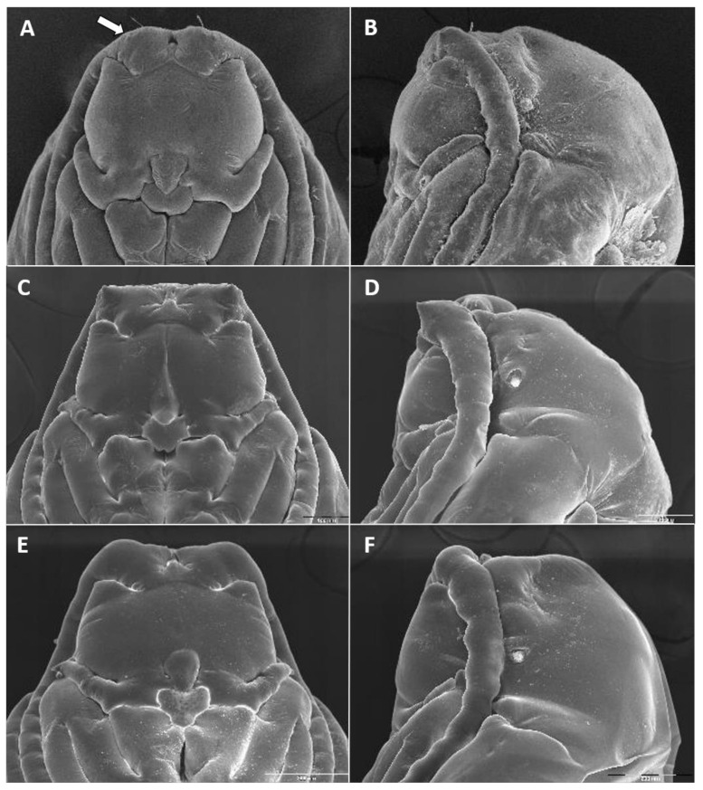 Figure 11