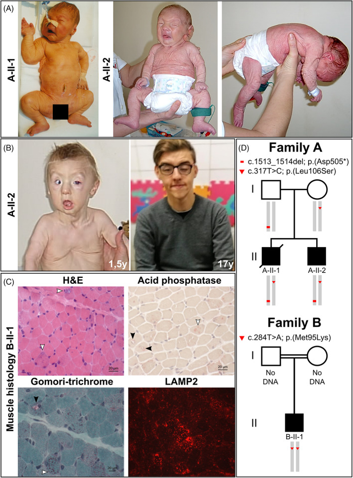 FIGURE 1