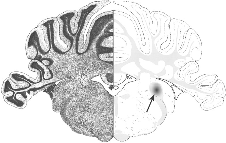 Fig. 1.