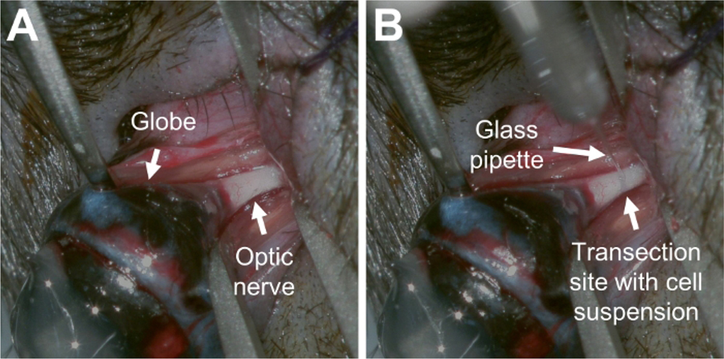 Figure 1: