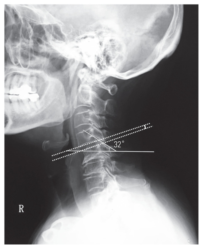 Fig. 3