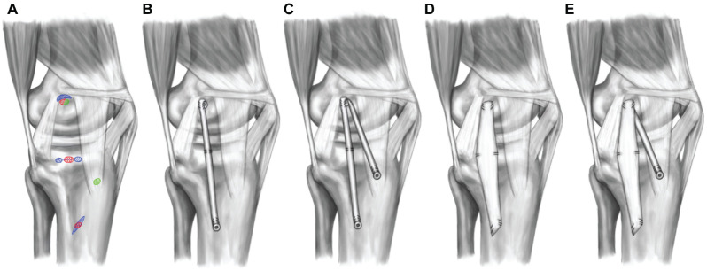 Figure 2.