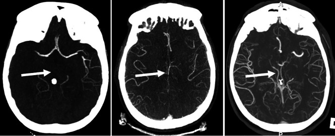 FIG 1.