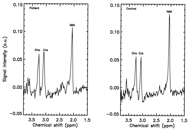 Fig 2.