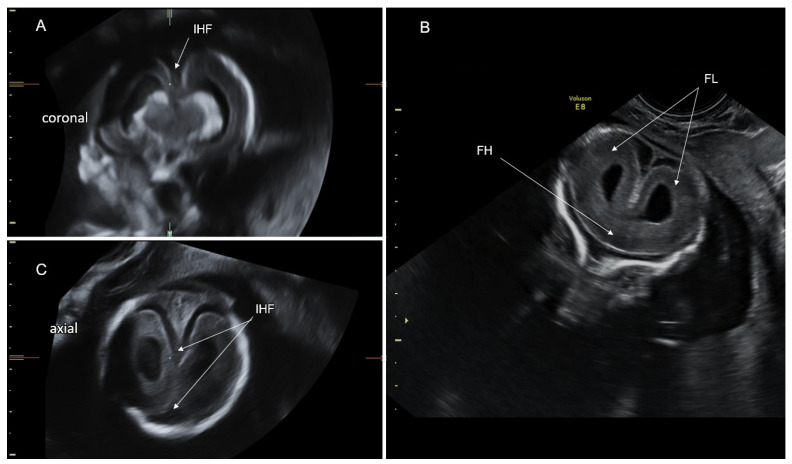 Figure 11