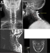 Fig. 6