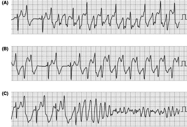 Figure 30