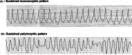 Figure 24
