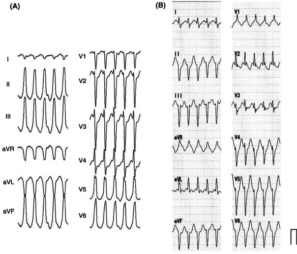 Figure 22