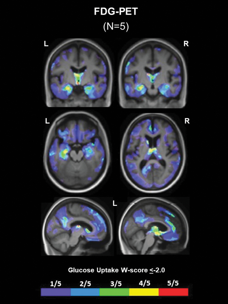 FIG. 3.