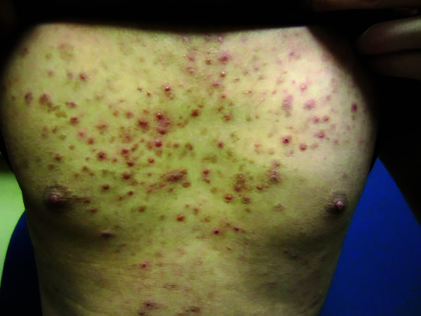 Figure 14