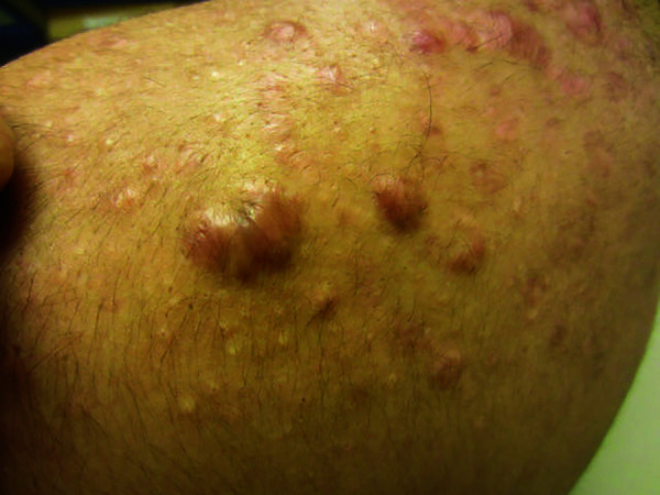 Figure 15