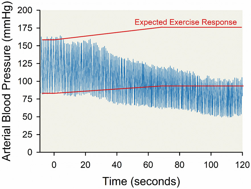 Figure 14.