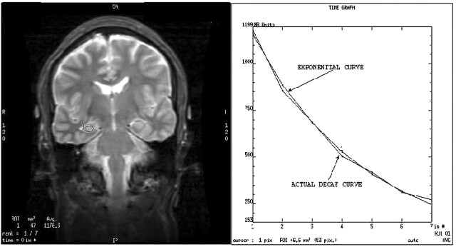 Fig 1.