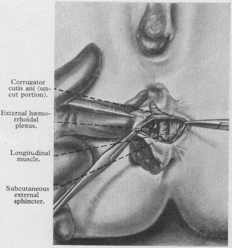 FIG. 9