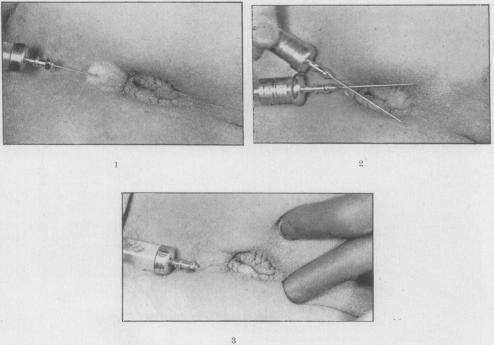 FIG. 18