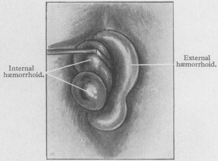 FIG. 8b