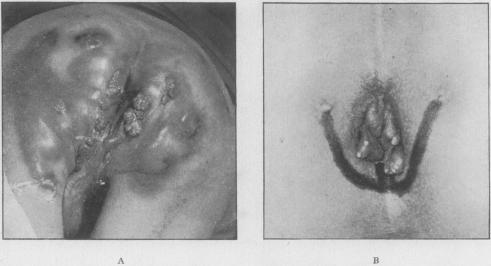 FIG. 17