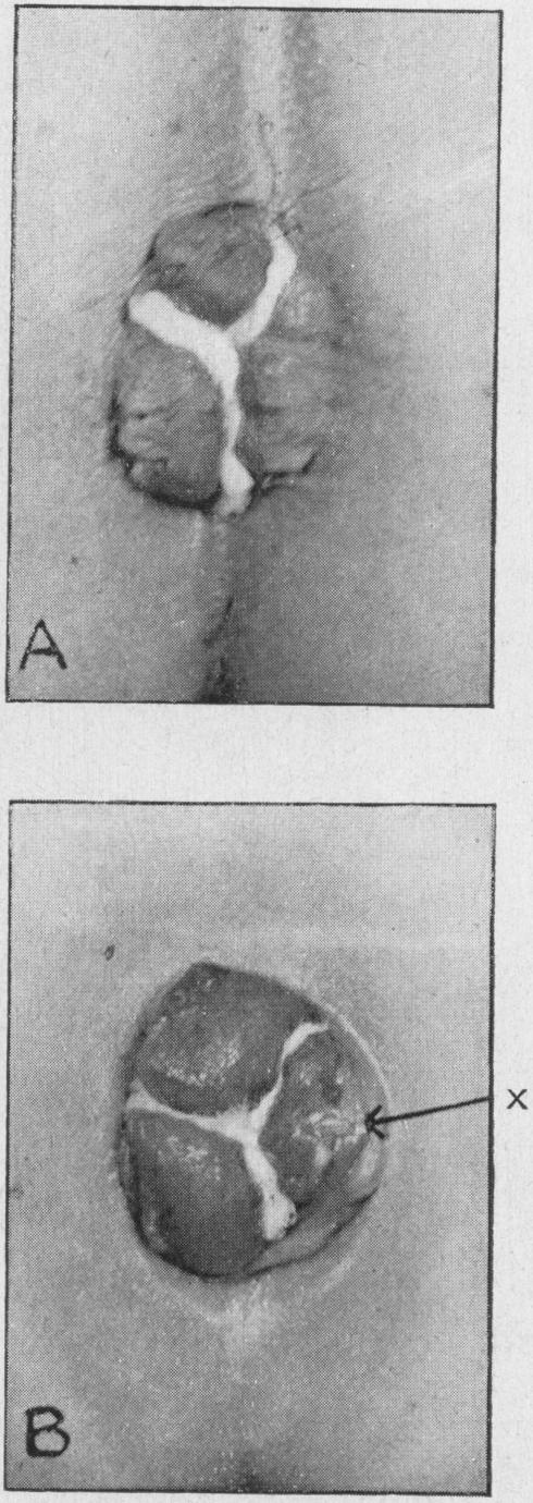 FIG. 10