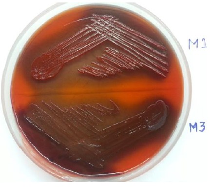 Figure 2: Congo-red agar – detection of biofilm