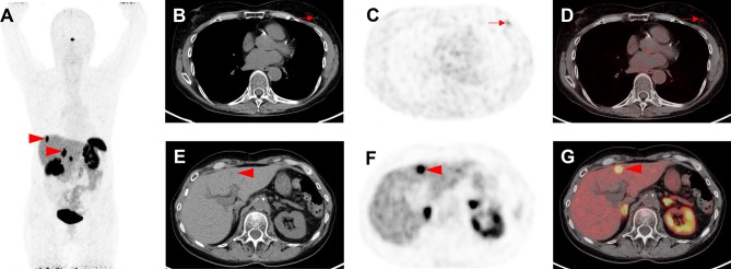 Fig. 5