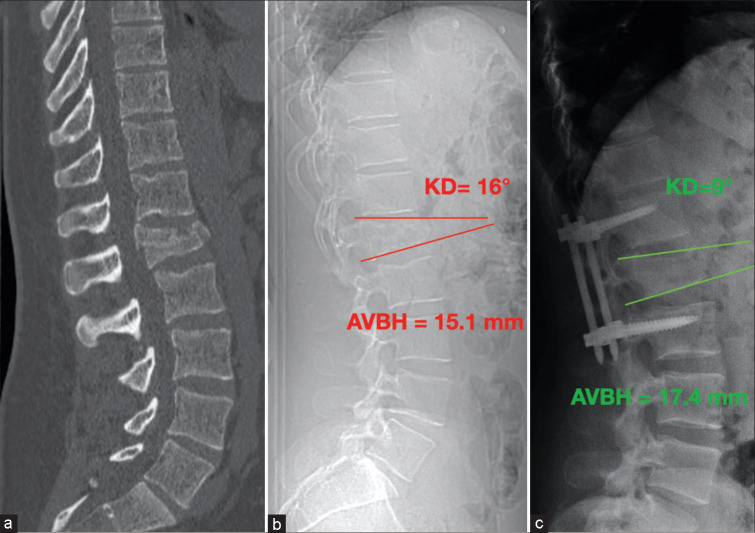 Figure 2: