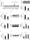 (a) Of the 15 predicted genes, only Bmpr2 gene expression was downregulated in 3T3-L1 cells. (b) BMPR2 protein expression was downregulated in 3T3-L1 after the transfection. (c) Bmpr2 gene expression was downregulated in differentiated 3T3-L1 cells. (d) BMPR2 protein expression was downregulated in differentiated 3T3-L1 after the transfection. (e) Bmpr2 gene expression was upregulated in 3T3-L1 after TNF-α stimulation. (f) BMPR2 protein expression was upregulated in 3T3-L1 after TNF-α stimulation for 4 and 6 h. (g) Bmpr2 gene expression was upregulated in differentiated 3T3-L1 after TNF-α stimulation. (h) BMPR2 protein expression was upregulated in differentiated 3T3-L1 after TNF-α stimulation for 4 and 6 h.