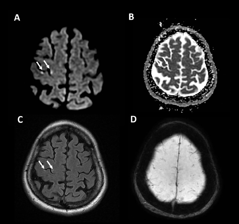 Fig 1