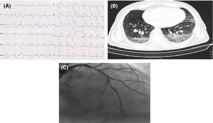 FIGURE 2