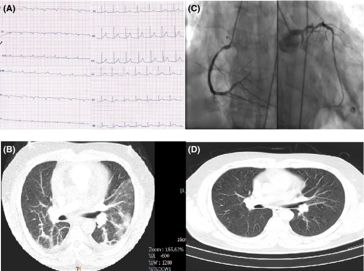 FIGURE 1