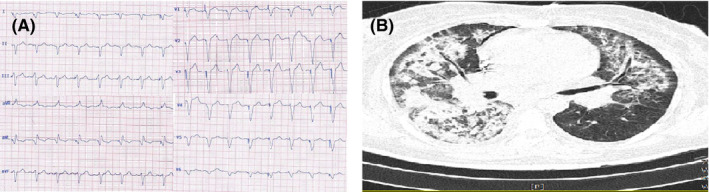 FIGURE 3