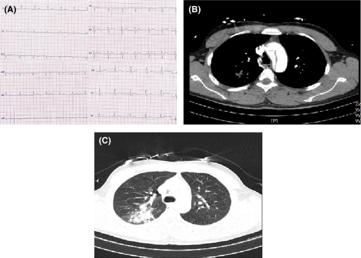 FIGURE 4