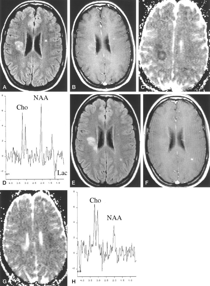 Fig 2.