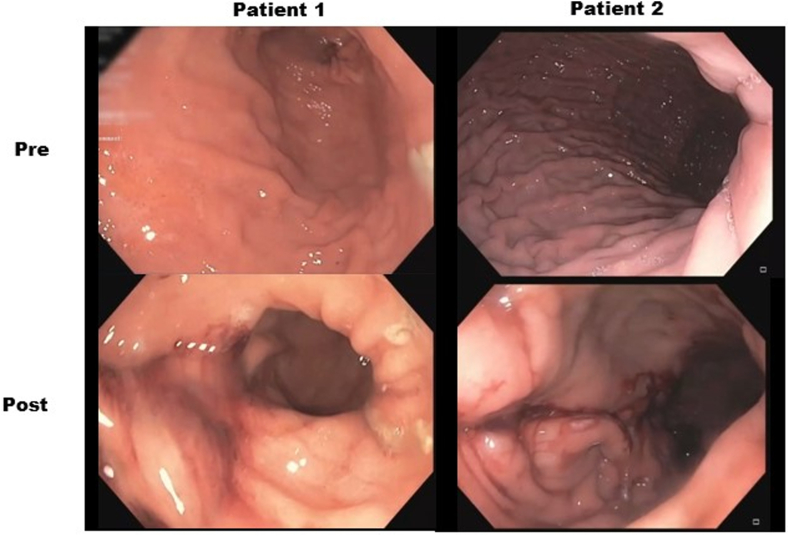 Figure 3