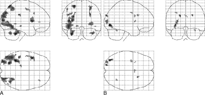 fig 3.