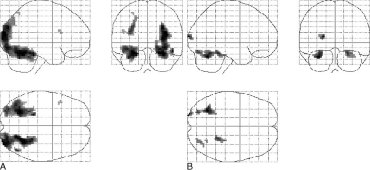 fig 1.