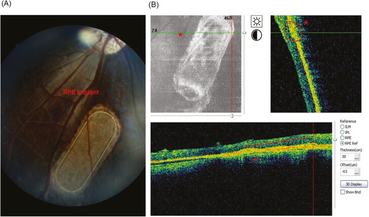 Figure 3.